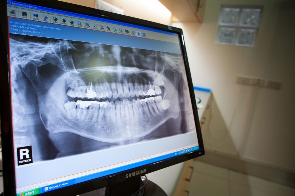 dental and craniofacial research