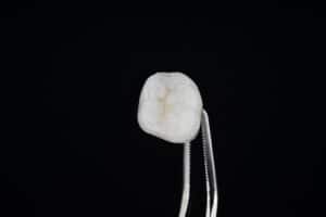A hemostat holds a dental crown.