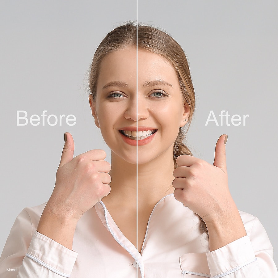 A woman gives the thumbs up in a smile makeover before and after pic.