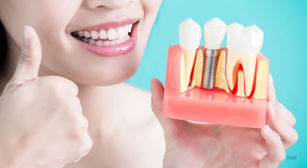 Female holding a model of a dental implant between two natural teeth.