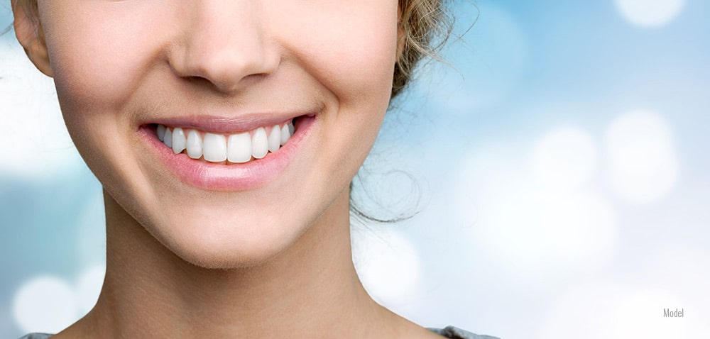 female smiling after a dental cleaning with light scaling.